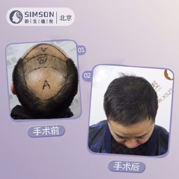 【头顶加密种植：揭秘未来农业革命的秘密武器】