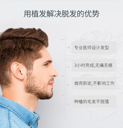 揭秘头发种植技术：如何让脱发不再是烦恼？
